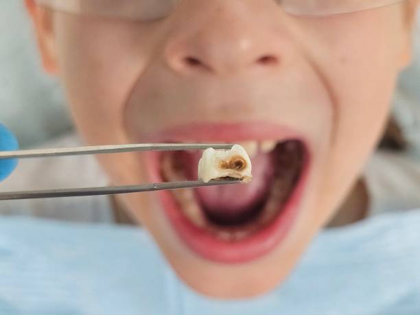 Best Knocked-Out Tooth Emergency  in West Branch, MI